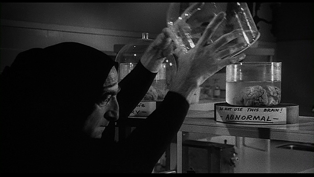 Young Frankenstein - Abnormal Brain